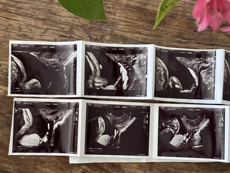 Keihard van de roze wolk afdonderden